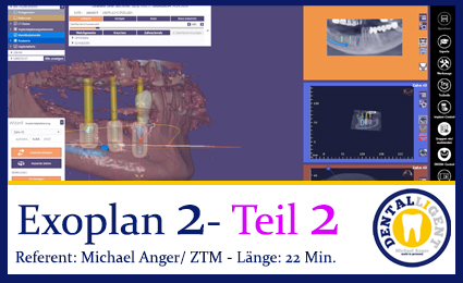 Product image 1 of the product “2019-Exocad  EXOPLAN 2 - Teil 2 ”