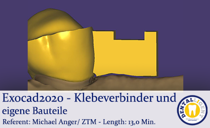 Product image 1 of the product “2020-Exocad - Exocad-Plovdiv – Mundscans + 3-Glieder-Brücke + Modelcreator ”