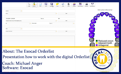 Product image 1 of the product “Free full EXOCAD SUPPORT-Video - About: The Exocad Orderlist About: The Exocad Orderlist ”