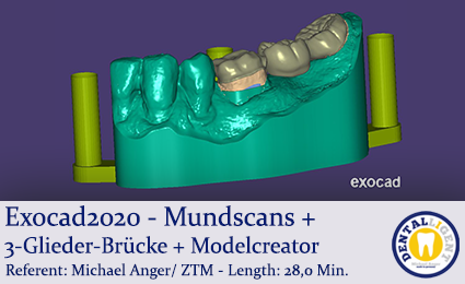 Artikelbild 1 des Artikels “2020-Exocad - Exocad-Plovdiv – Mundscans + 3-Glieder-Brücke + Modelcreator “