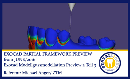 Product image 1 of the product “2016-EXOCAD  -Exocad Modellgussmodellation Preview 2 Teil 3 ”