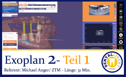 Artikelbild 1 des Artikels “2019-Exocad  EXOPLAN 2 - Teil 1 “