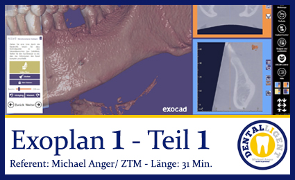 Product image 1 of the product “2019-Exocad  EXOPLAN 1 - Teil 1 ”