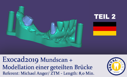 Product image 1 of the product “Exocad2019  - TEIL 2 - Mundscan + Modellation einer geteilten Brücke ”
