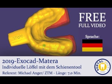 Product image 1 of the product “2019 - FREE FULL TUTORIAL in DEUTSCH -  Exocad-Matera Individuelle Löffel mit dem Schienentool ”