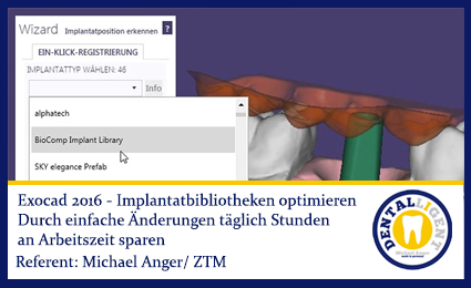 Product image 1 of the product “2016-EXOCAD  - Implantatbibliotheken optimieren ”