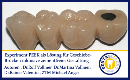 Artikelbild 1 des Artikels “GRATIS - Experiment - PEEK als Lösung für Geschiebe-Brücken inkl. zementfreier Gestaltung “