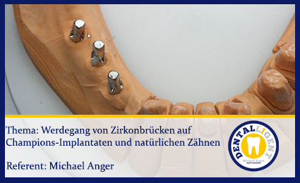 Product image 1 of the product “Werdegang von Zirkonbrücken auf Champions-Implantaten und natürlichen Zähnen ”