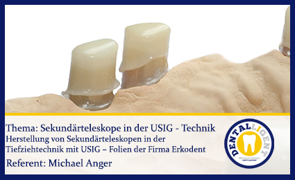 Product image 1 of the product “GRATIS - Sekundärteleskope in der USIG - Technik ”