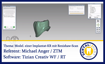 Product image 1 of the product “Modellveränderungen bei Modellation einer Implantatkrone mit Renishaw-Scan ”