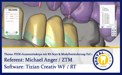 Product image 1 of the product “PEEK-Aussenteleskope mit Renishaw-Scan & Modellveränderung - Teil 1 ”