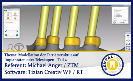 Product image 1 of the product “Modellation der Tertiärstruktur auf Implantaten oder Teleskopen - Teil 2 ”
