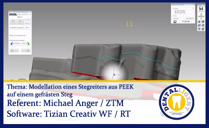 Product image 1 of the product “Modellation eines Stegreiters aus PEEK auf einem gefrästen Steg ”