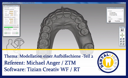 Product image 1 of the product “Modellation einer OK-Aufbissschiene - Teil 2 ”