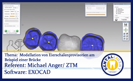 Product image 1 of the product “Modellation von Eierschalenprovisorien am Beispiel einer Brücke ”