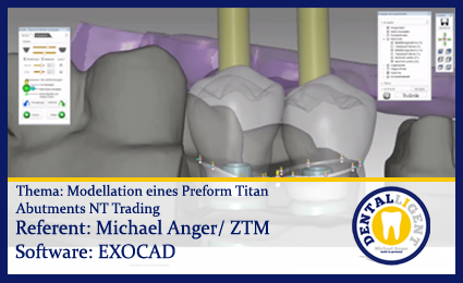 Product image 1 of the product “Modellation eines Preform Titan Abutments NT Trading ”