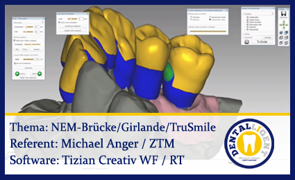 Artikelbild 1 des Artikels “NEM-Brücke mit Girlande, TruSmile & Nachbearbeitung “