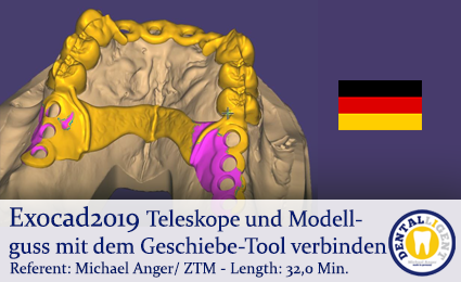 Product image 1 of the product “Exocad2019  - Teleskope und Modellguss mit dem Geschiebe-Tool verbinden ”
