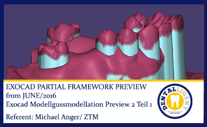 Product image 1 of the product “2016-EXOCAD - Exocad Modellgussmodellation Preview 2 Teil 1 ”