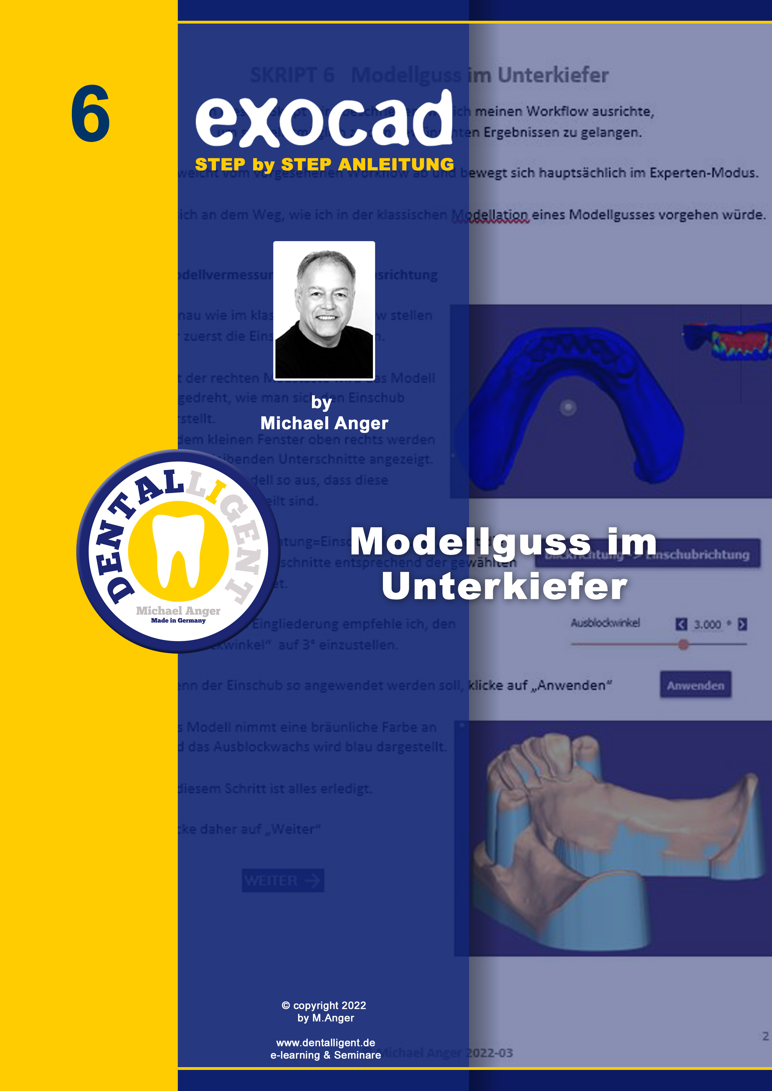 Product image 1 of the product “Exocad Step by Step Anleitung - Nr. 6 -  Modellguss im Unterkiefer ”