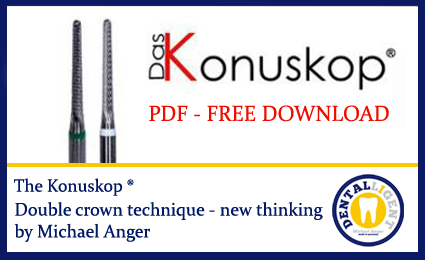 Product image 1 of the product “The Konuskop® - double crown technique ”