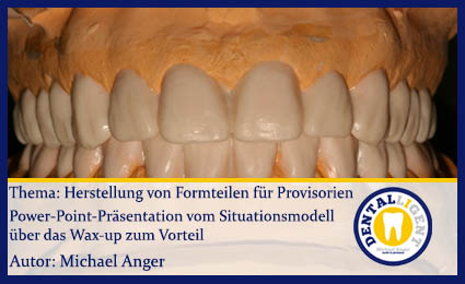 Product image 1 of the product “GRATIS - Thema: Herstellung von Formteilen für Provisorien ”