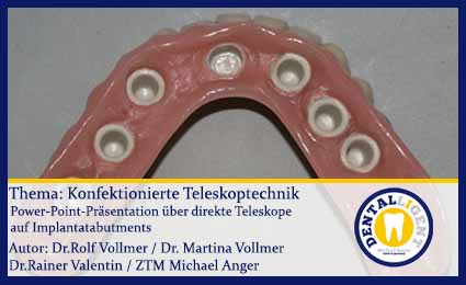 Product image 1 of the product “GRATIS - Konfektionierte Teleskoptechnik ”