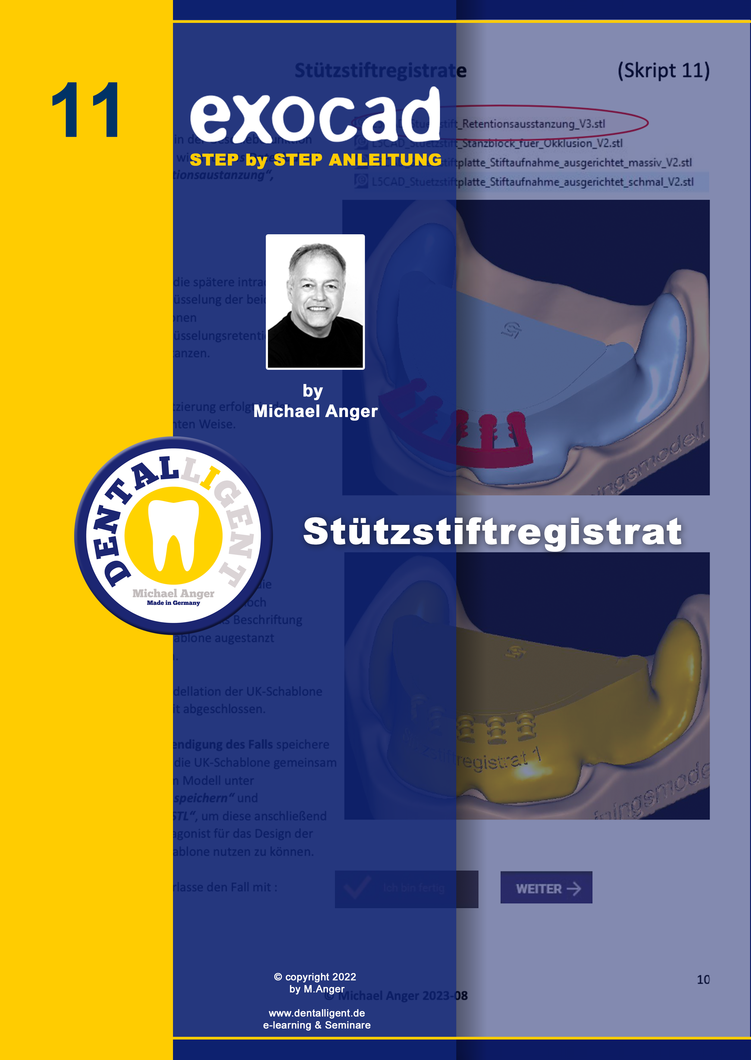 Product image 1 of the product “Exocad Step by Step Anleitung - Nr. 11 - Stützstiftregistrat ”