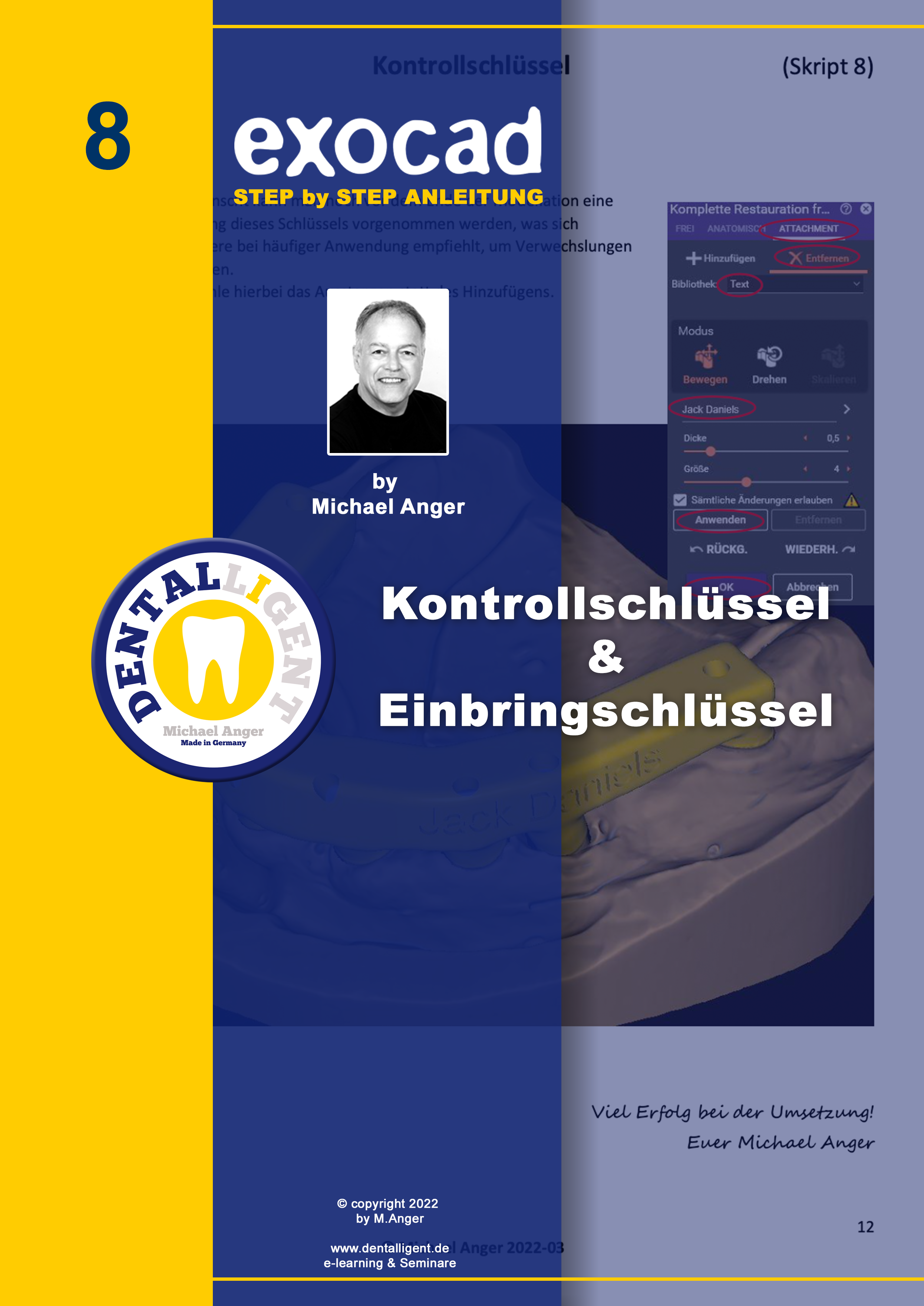 Product image 1 of the product “Exocad Step by Step Anleitung - Nr. 8 - Kontrollschlüssel & Einbringschlüssel ”