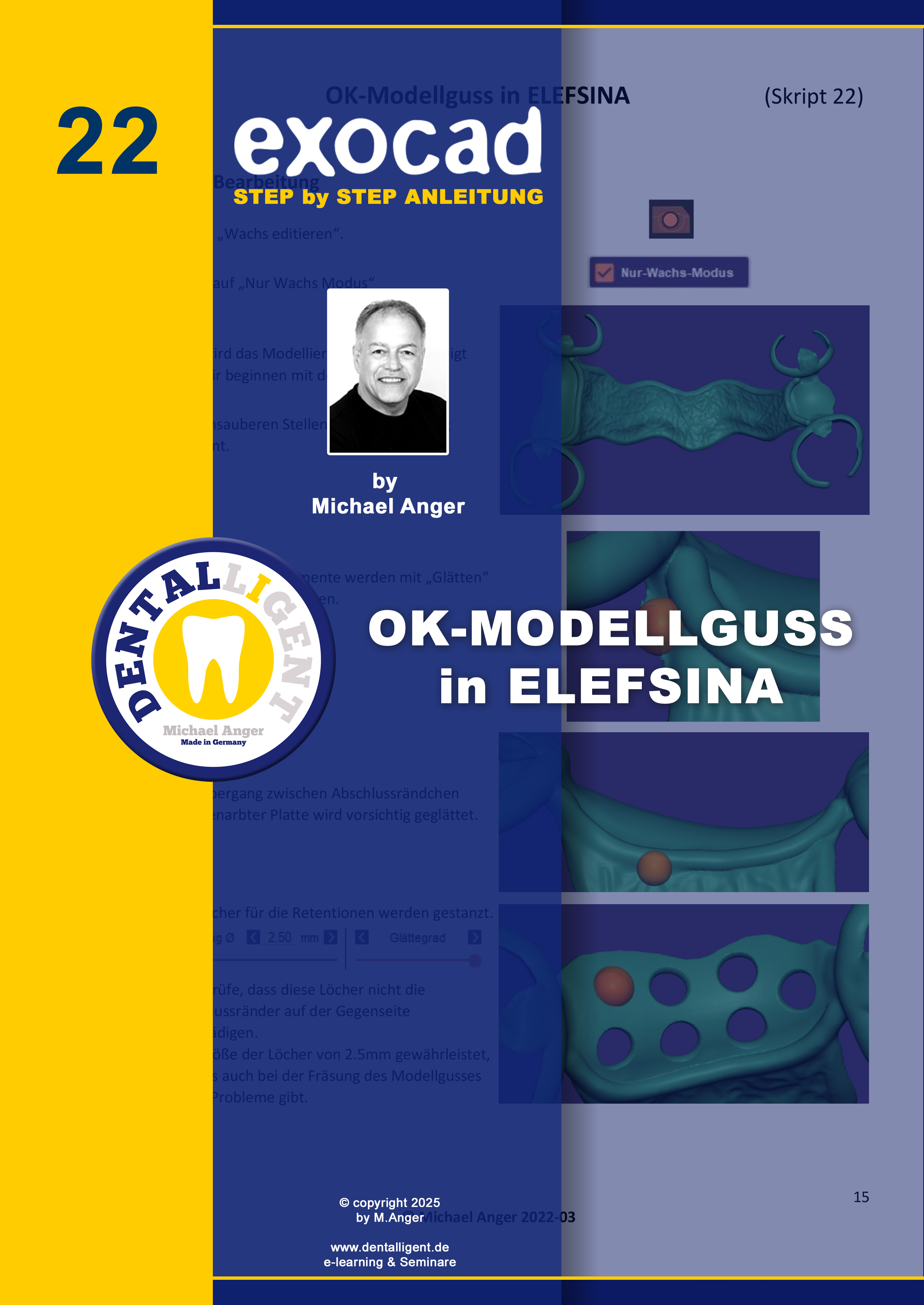 Artikelbild 1 des Artikels “Exocad Step by Step Anleitung - Nr. 22 OK-Modellguss in ELEFSINA “