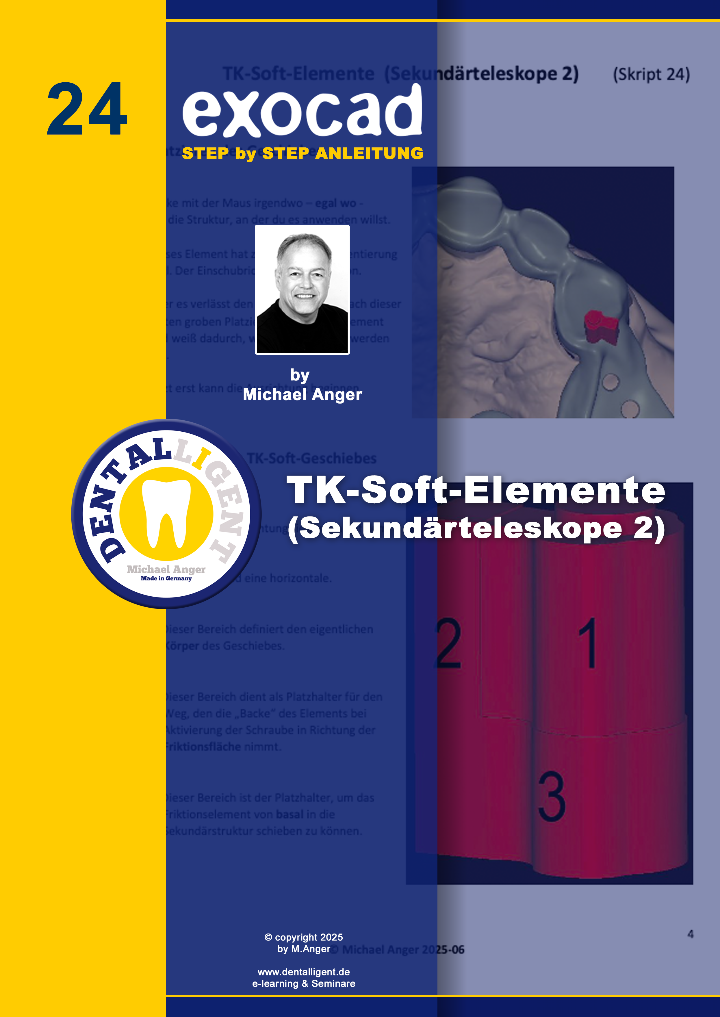 Artikelbild 1 des Artikels “Exocad Step by Step Anleitung - Nr. 24 TK-Soft-Elemente (Sekundärteleskope 2) “