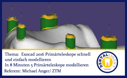 Product image 1 of the product “2016-FREE FULL VIDEO - EXOCAD 2016 - Exocad 2016 Primärteleskope schnell und einfach modellieren ”