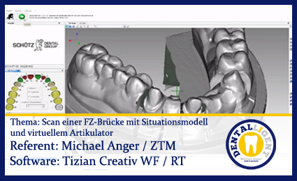 Product image 1 of the product “Scan einer FZ-Brücke mit Situationsmodell und virtuellem Artikulator ”
