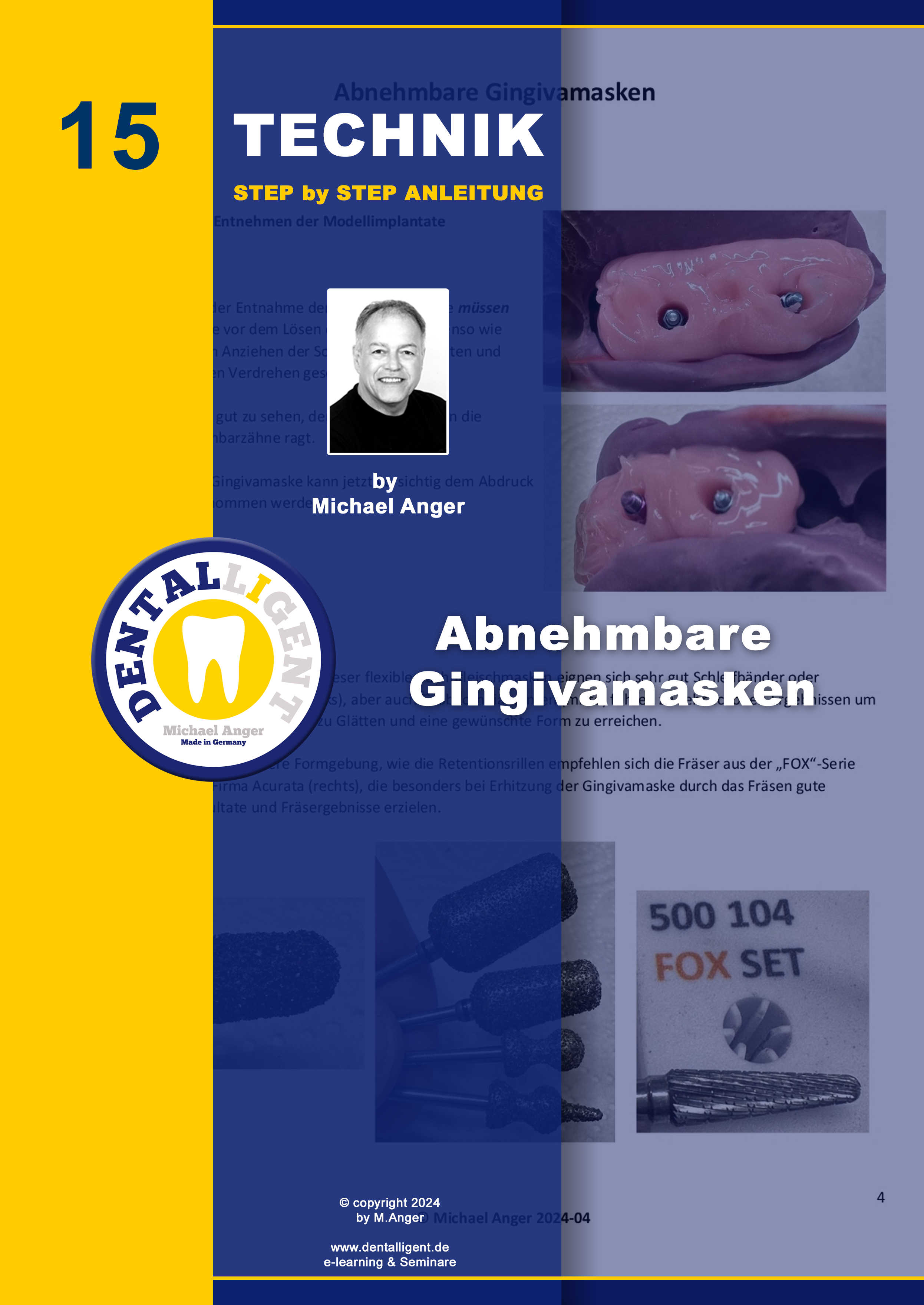 Product image 1 of the product “Technik Step by Step Anleitung - Nr. 15 Abnehmbare Gingivamasken ”