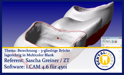 Product image 1 of the product “Berechnung – 3-gliedrige Brücke lagerichtig in Multicolor Blank ”