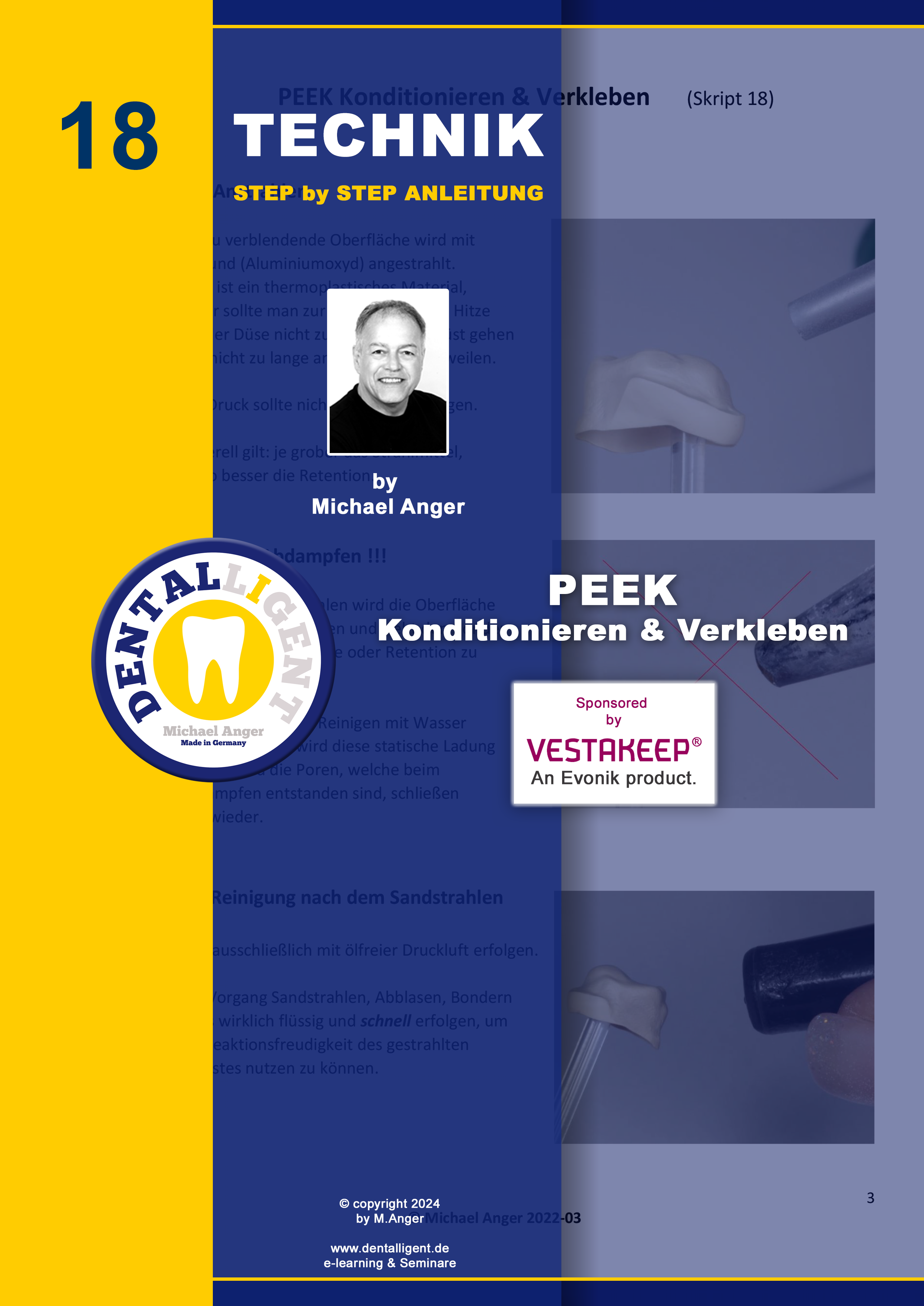 Artikelbild 1 des Artikels “Technik Step by Step Anleitung - Nr. 18 PEEK Konditionieren & Verkleben “