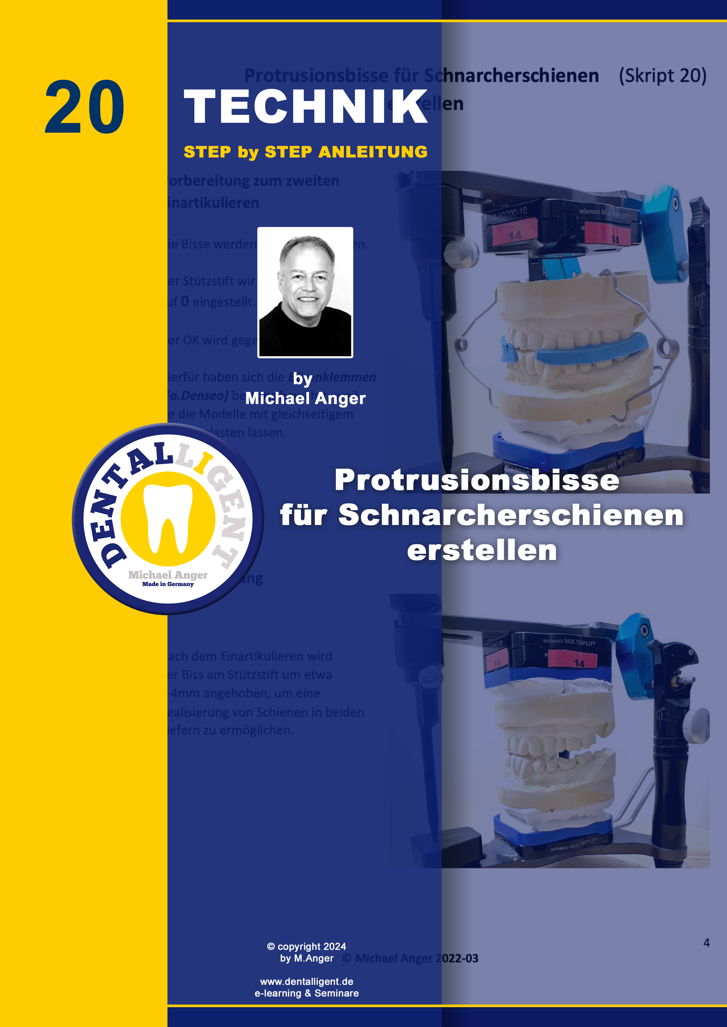 Artikelbild 1 des Artikels “Technik Step by Step Anleitung - Nr. 20 Protrusionsbisse für Schnarcherschienen erstellen “
