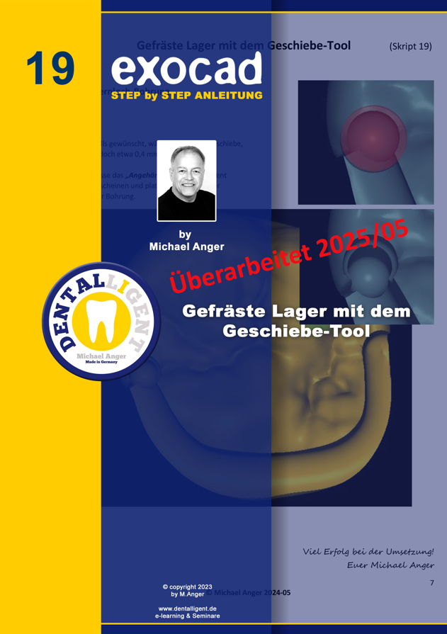 Product image 1 of the product “Exocad Step by Step Anleitung - Nr. 19 Gefräste Lager mit dem Geschiebe-Tool ”