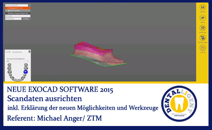 Product image 1 of the product “2015-Scandaten ausrichten - Exocad 2015 ”