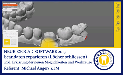 Artikelbild 1 des Artikels “2015-Scandaten reparieren (Löcher schliessen) - Exocad 2015 “