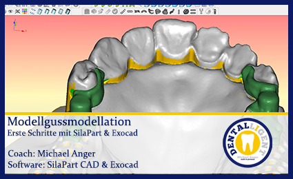 Product image 1 of the product “Modellgussmodellation - Erste Schritte mit SilaPart & Exocad ”