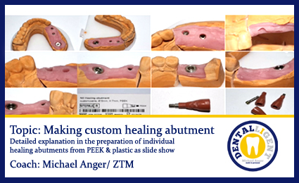 Product image 1 of the product “Topic: Making custom healing abutment ”