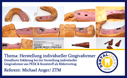 Product image 1 of the product “TIPPS & TRICKS - Herstellung individueller Gingivaformer ”