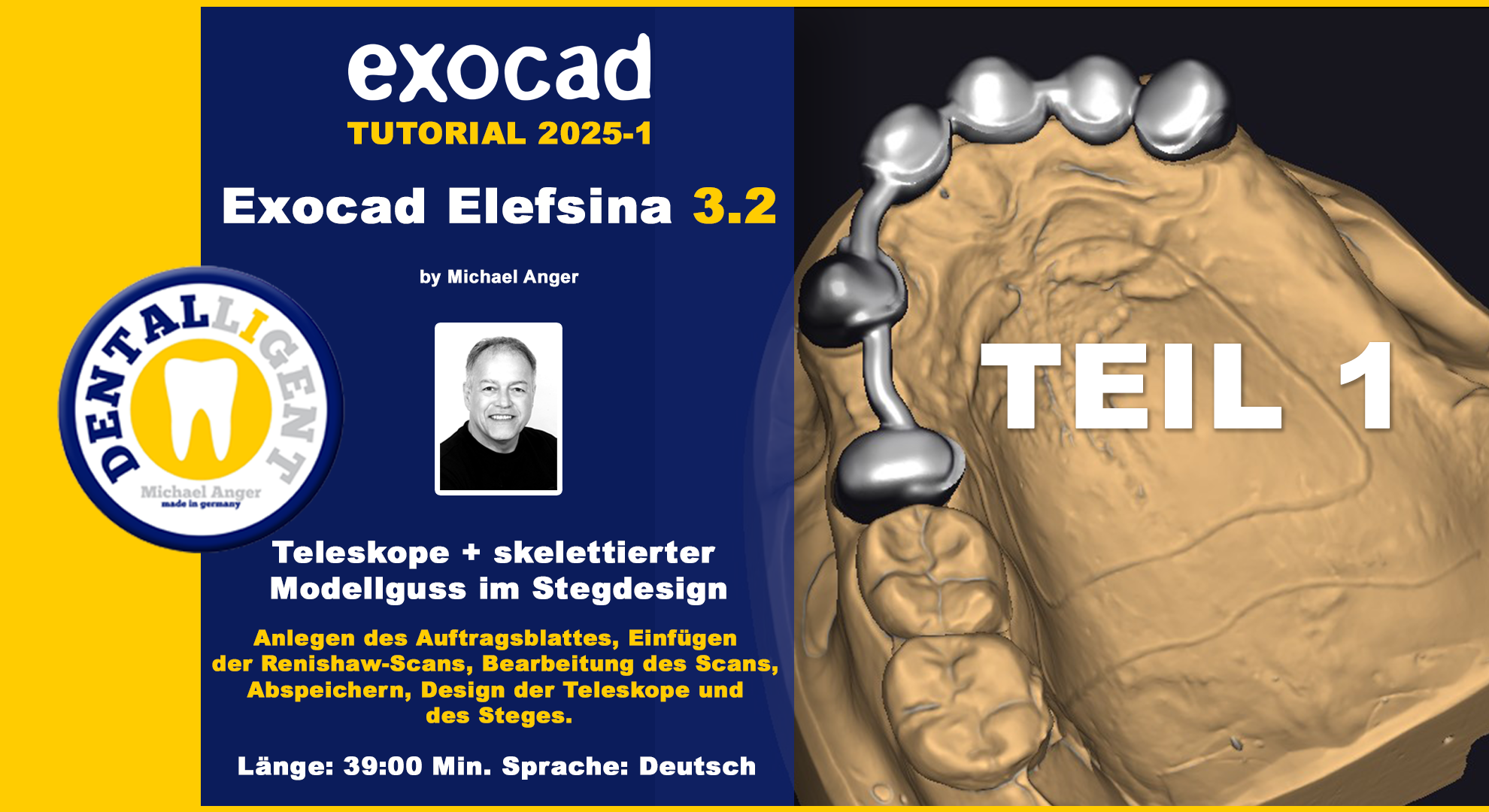 Product image 1 of the product “Exocad Elefsina 3.2 - 2025-1 - Teleskope + skelettierter Modellguss im Stegdesign TEIL 1 ”