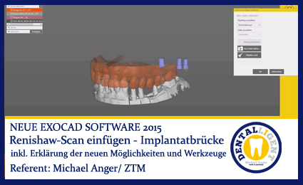 Product image 1 of the product “2015-Renishaw-Scan einfügen (Beispiel Implantatbrücke) - Exocad 2015 ”