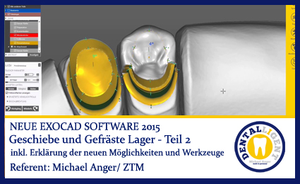Product image 1 of the product “2015-Geschiebe und Gefräste Lager - Teil 2 - Exocad 2015 ”