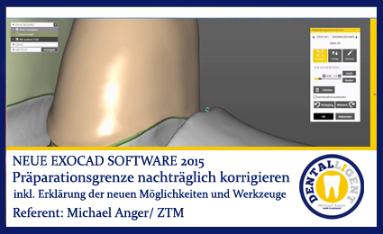 Artikelbild 1 des Artikels “2015-Präparationsgrenze nachträglich korrigieren - Exocad2015 “