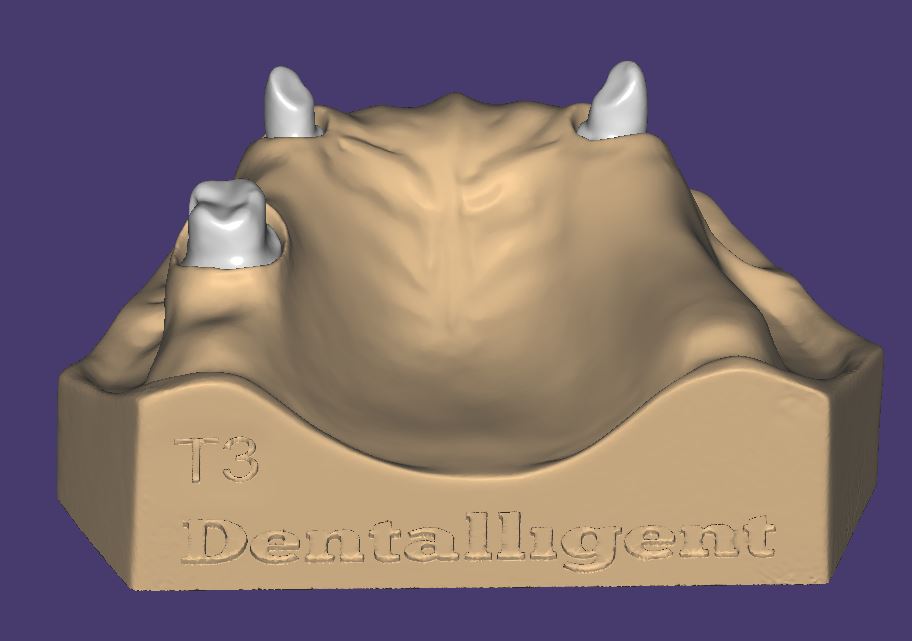 Product image 2 of the product “OK-Model T3-STL-Files for self-print ”