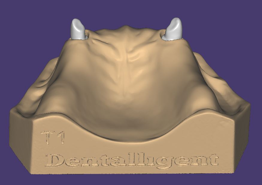 Product image 2 of the product “OK-Model T1-STL-Files for self-print ”