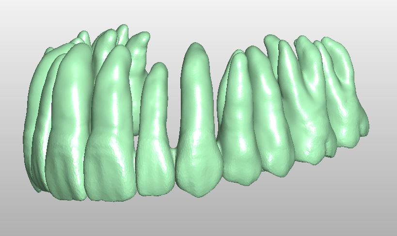 Product image 2 of the product “STL-FILES  - upper jaw & lower jaw teeth row matching each other to print by yourself. ”
